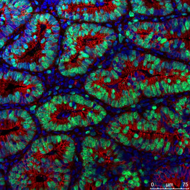 康涅狄格大学免疫学研究员揭示细胞因子和结直肠癌之间的关系