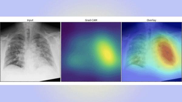 AI通过胸片检测COVID-19比专业放射科医生更准确，速度快10倍