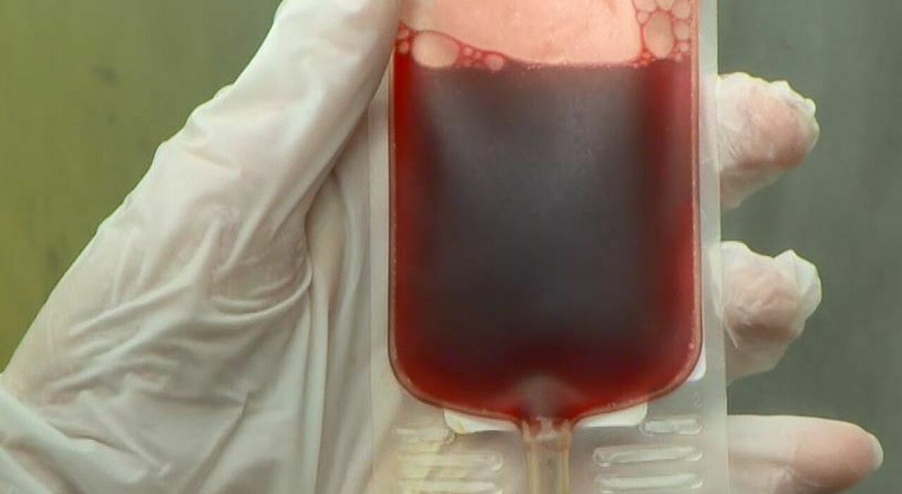 西尼罗河病毒在捐献者的血袋里发现